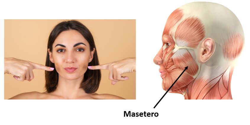 masetero